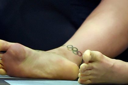 Ayak Sararması Neden Olur? 6 ayakta sararma2