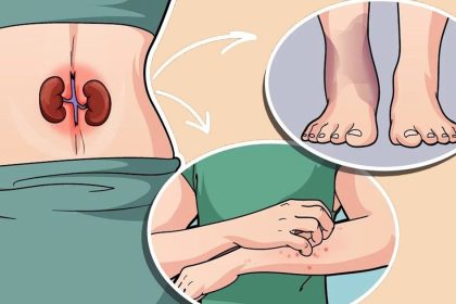 Böbreklerimiz Sağlıklı Olmadığında Bu 7 İşareti Vücudumuza Gönderiyor 6 bobreklerimiz saglikli olmadiginda bu 7 isareti vucudumuza gonderiyor