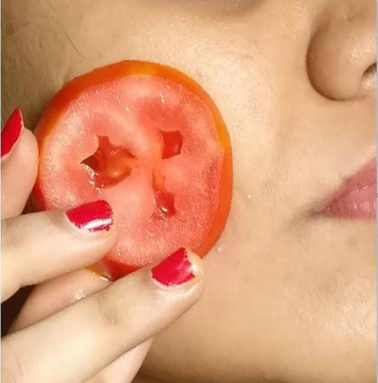 Yüzünüzdeki veya Vücuttaki Kırmızı Lekelerin Sebebi Nedir? Ne İyi Gelir? 9 domates 1