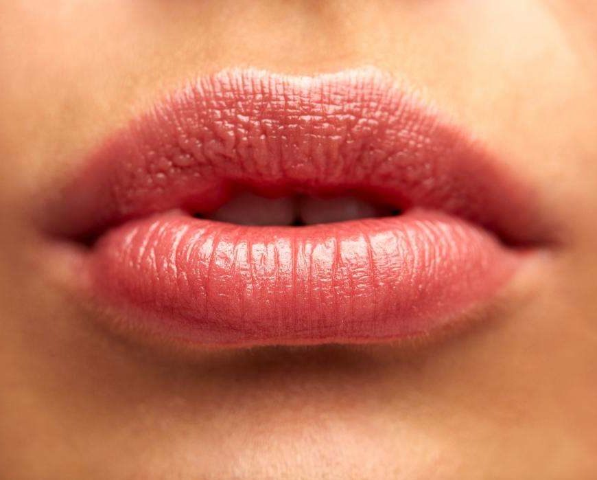 dudak çatlaklığı