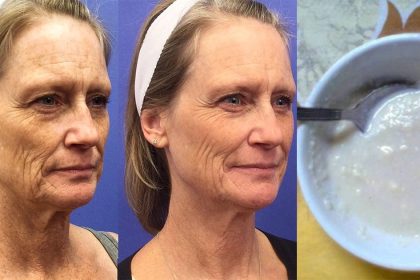 Bu Krem Sizi Çok Sevindirecek! Yalnızca 4 Gün İçerisinde 10 Yaş Daha Genç Görüneceksiniz 12 genclesme tarifi