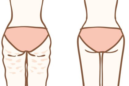 Her Kadın Hayatını Kolaylaştıracak Bu Basit Ve Şaşırtıcı Sırları Bilmeli 18 her kadin bu basit ve sasirtici sirlari bilmeli