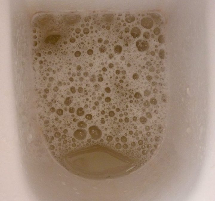 idrardaki kabarciklar e1568461775955