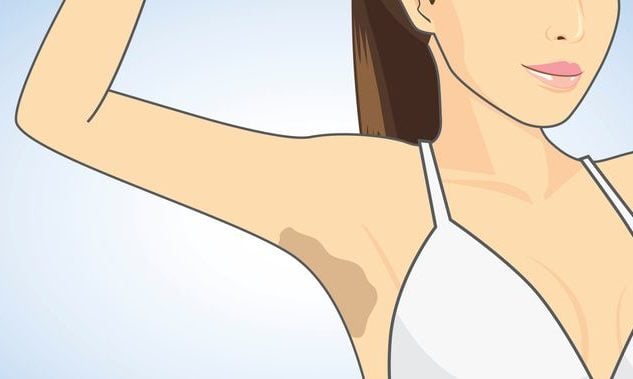 Her Kadın Hayatını Kolaylaştıracak Bu Basit Ve Şaşırtıcı Sırları Bilmeli 8 kararmis koltuk alti e1569594563247