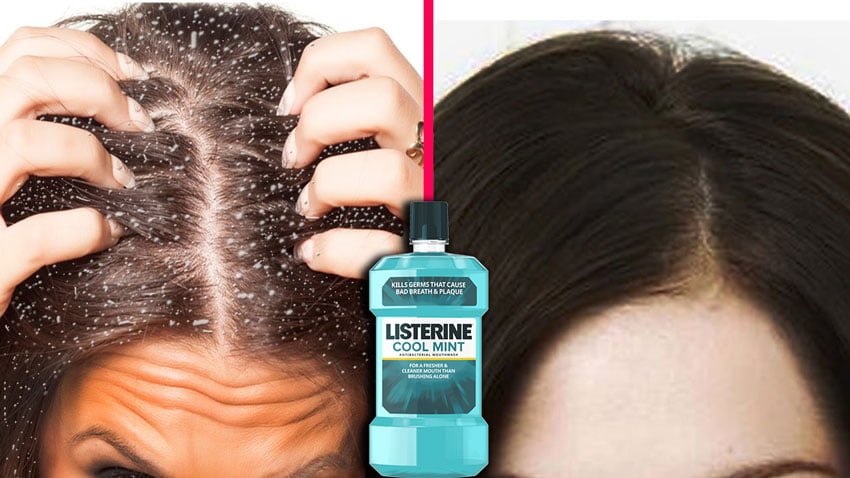 Ağız Gargarasıyla Neler Yapılabilir? 3 kepek2