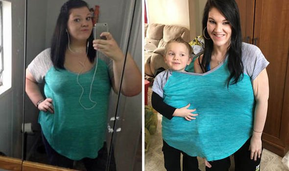 Amerikalı Obezleri Zayıflatan Krem 7 Günde 5 Kilo Verdiriyor 2 obez oncesi sonrasi