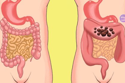 Sağlıklı Bağırsaklara Sahip Olmanın 7 Yolu 22 saglikli bagirsaklara sahip olmanin 7 yolu