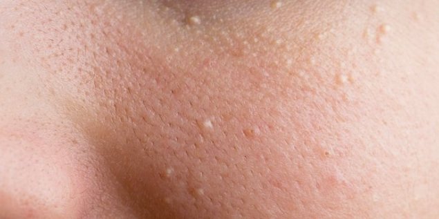 Her Kadın Hayatını Kolaylaştıracak Bu Basit Ve Şaşırtıcı Sırları Bilmeli 7 siyah nokta 2