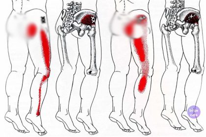Sırt Ağrınız Varsa Bu Yöntemi Uygulayın 2 ssirt