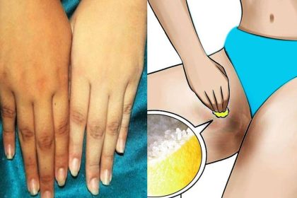 Vücuttaki Kararmalardan Nasıl Kurtulursunuz? 20 ten beyazlastirma