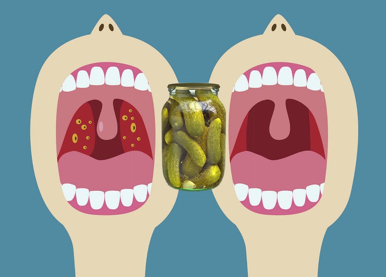 Turşu Suyu ile Yapabileceğiniz 10 Farklı Şey 7 tursusuyu4