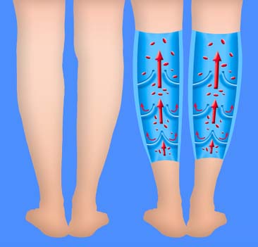 önemli ipuçları varis