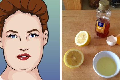 Yüz Yağlarından Kurtulmanın 5 Kolay Yolu ve 1 Maskesi 16 yuzdeki yaglardan kurtulma