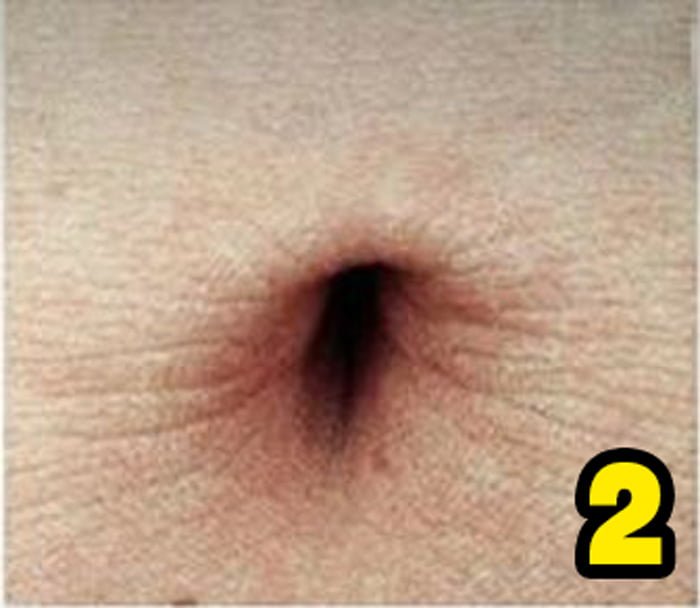 Göbek Deliğinizin Şekli Sağlığınızla İlgili Çok Şeyi Söylüyor 4 2 2