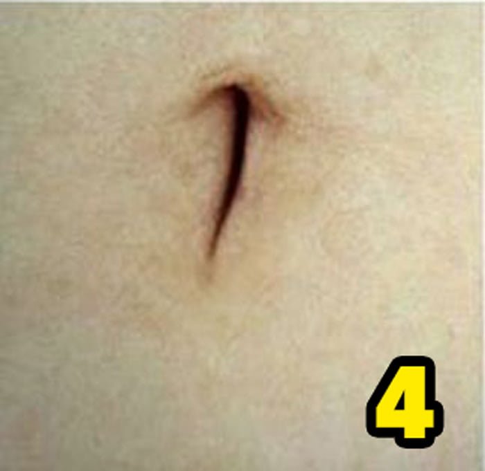 Göbek Deliğinizin Şekli Sağlığınızla İlgili Çok Şeyi Söylüyor 6 4 1