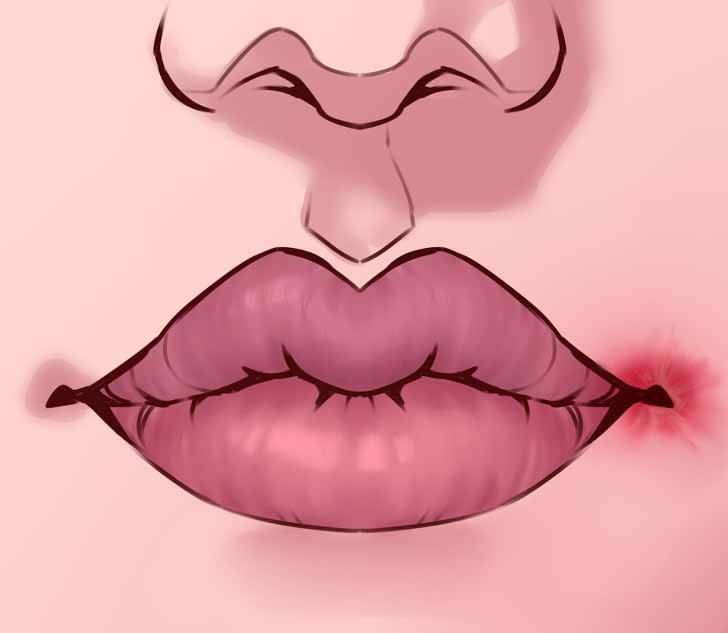 agiz kosesindeki catlaklar1