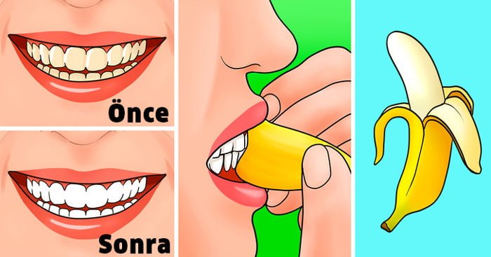 Muz Kabuğunu ile Yapılabilecek 6 Muhteşem Fikir 5 beyaz disler