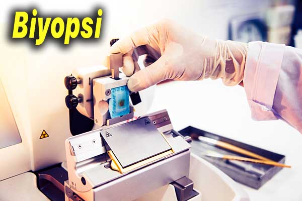 biyopsi