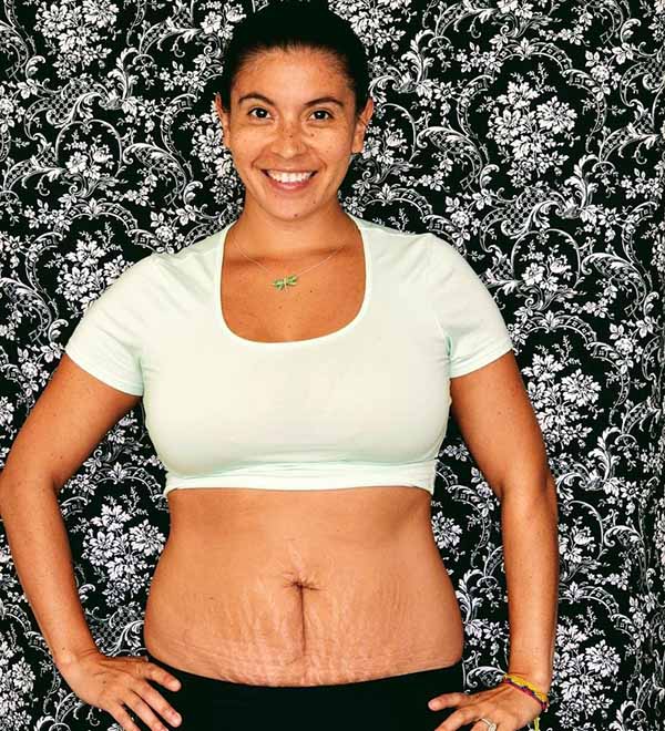 Doğumdan Sonra Karnını Gösterme Cesaretinde Bulunan 8 Efsane Kadın 4 dogum sonrasi fotografi 3