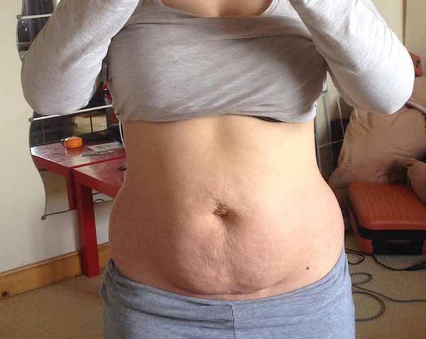 Doğumdan Sonra Karnını Gösterme Cesaretinde Bulunan 8 Efsane Kadın 5 dogum sonrasi fotografi 4