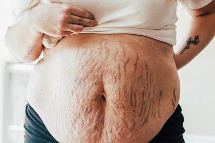 doğumdan sonra karnını gösterme cesaretinde bulunan 8 efsane kadın