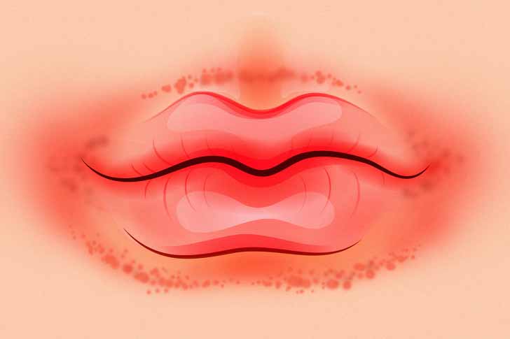 dudak cevresinde kirmizi halkalar1