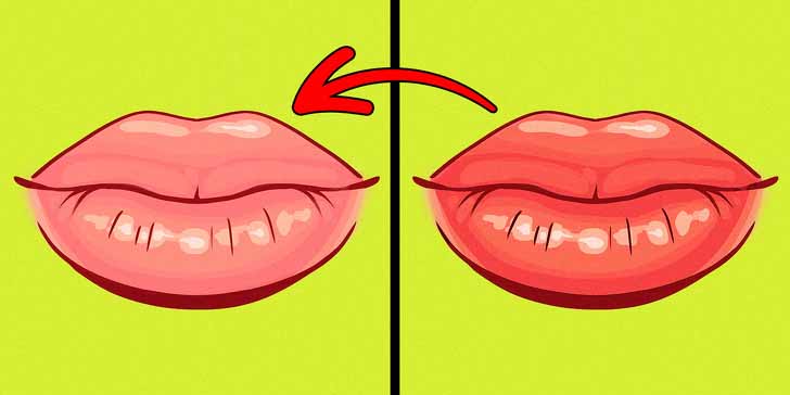 dudak renginin solmasi1