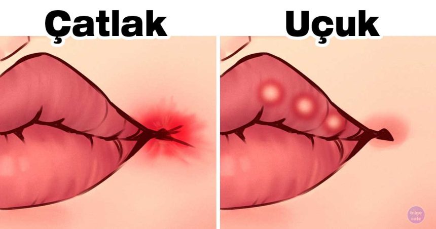 dudaklariniz sagliginiz hakkinda ne soyluyor