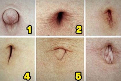 Göbek Deliğinizin Şekli Sağlığınızla İlgili Çok Şeyi Söylüyor 8 gobek sekli