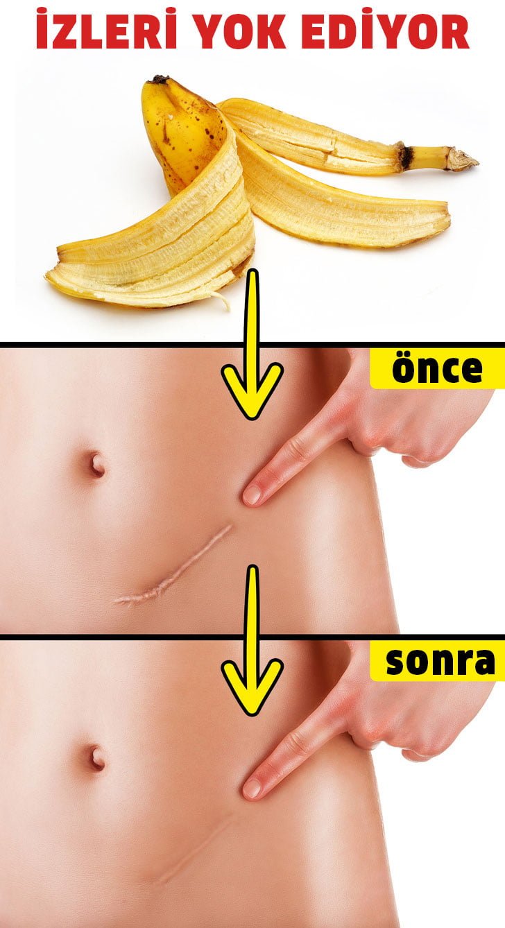 Muz Kabuğunu ile Yapılabilecek 6 Muhteşem Fikir 8 izler
