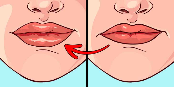 kabarik dudaklar1