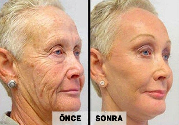 Her Sabah Yüzünüzü Bu 2 Malzemeli Karışımla Yıkayın 2 kadin