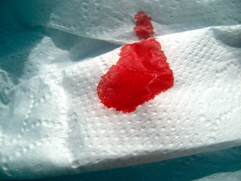 Asla Gözardı Etmemeniz Gereken 6 Mide Ağrısı 4 kanli