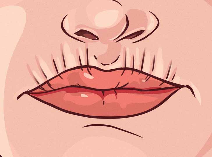 ust dudak bolgesinde kirisiklik1