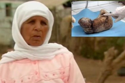 Karnındaki Bebeğini 50 Yıl Sonra Doğurdu 14 50yil dogurmadi