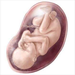 Karnındaki Bebeğini 50 Yıl Sonra Doğurdu 3 bebek