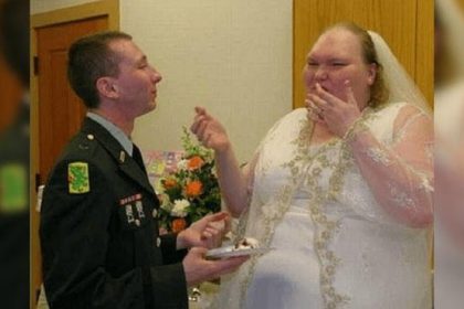 En Çirkin Kadın İlan Edilmişti.Şimdiki Halini Görenler Tanıyamıyor.. 12 cift1 1