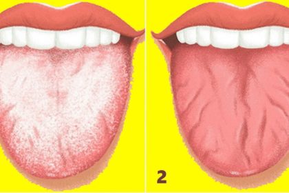 dilinizdeki bu degisikler hastalik belirtisi olabilir