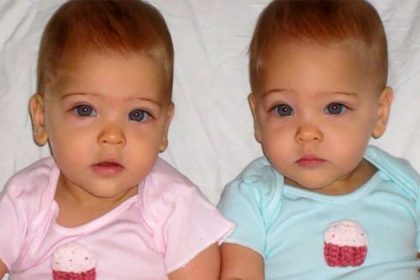 dunyanin en guzel ikizleri22