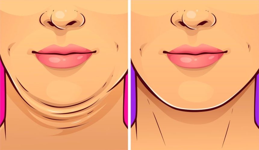 Gıdı Nasıl Gider? Ne İyi Gelir? 1 gidi