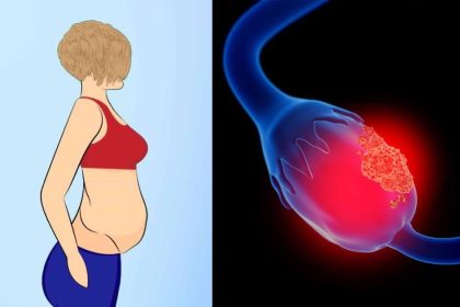 yumurtalik kanseri belirtileri