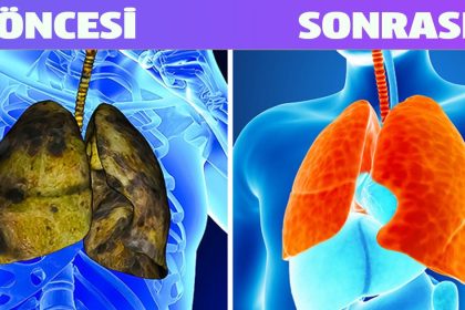Akciğerlerinizi Seviyorsanız Bu 5 Konuda Taviz Vermeyin 4 akciger oncesi sonrasi