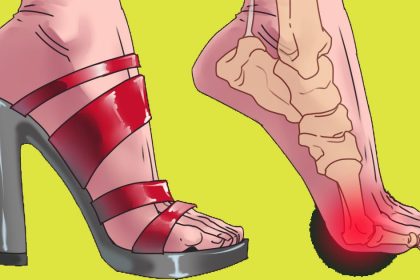 Topuklu Ayakkabının Zararları 20 yuksek topuklu ayakkabi