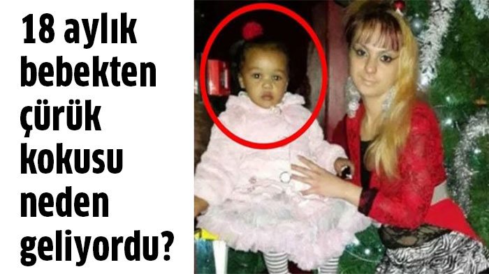 18 Aylık Kızdan Tuhaf Bir Koku Geliyordu Sebebini Öğrenince Hayrete Düştüler 2 neden geliyordu