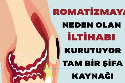 Romatizmadaki İltihabı Kurutuyor 2 romatizma4
