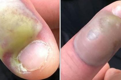 Tırnaklarını Yiyen Kadının Başına Gelenler 2 tirnaklar