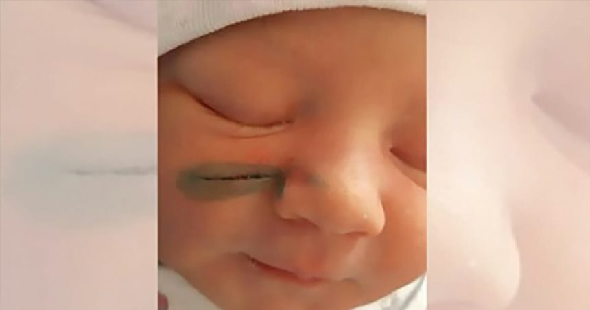 Bebeğin Başına Bunlar Geldi 1 cocuk yuzu2