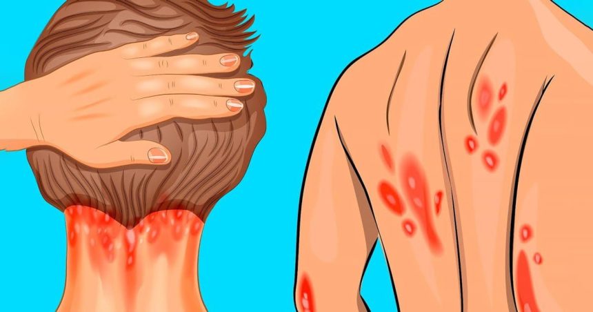 Vücudunuzdaki D Vitamini Eksikliğini 13 Belirtisi 1 dvitamin ek