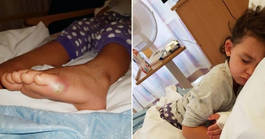 Çorapsız Ayakkabı Giyen Çocuğun Ayağı Böyle Oldu 1 kizin ayagi