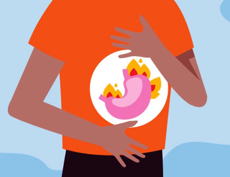 Mide Yanmasını Anında Geçiren 2 Malzemeli Karışım 2 mide yanmasi